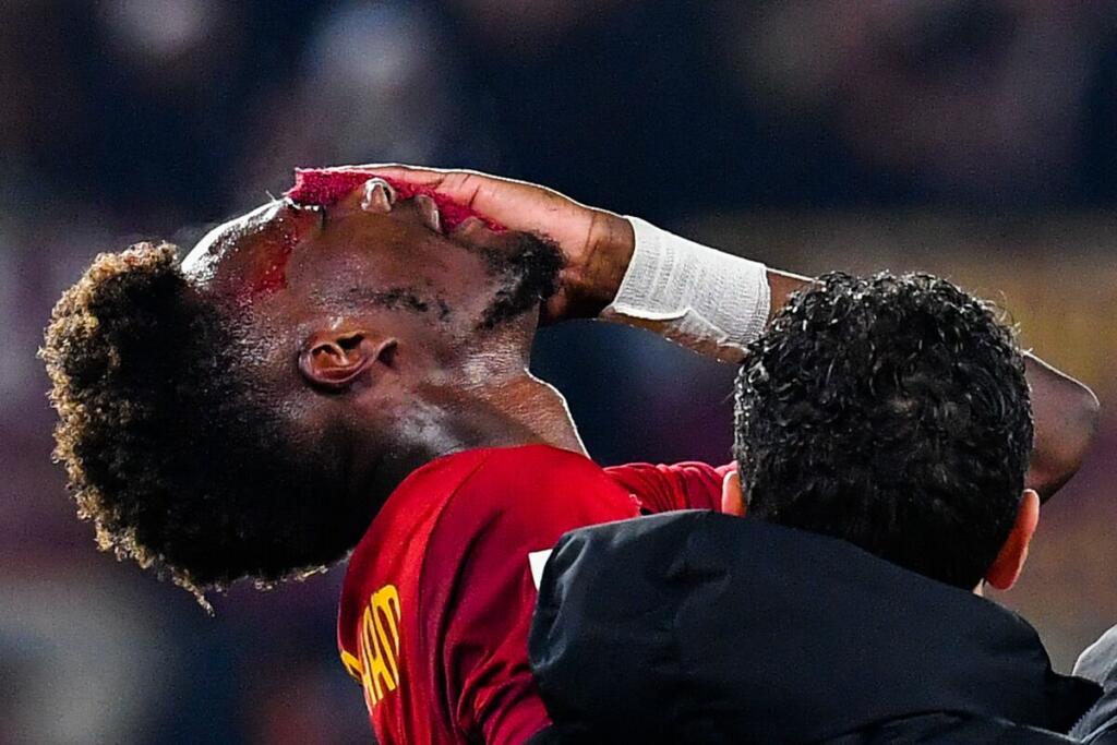 Infortunio Abraham, c’è l’intervento: ecco le ultime verso l’Europa League