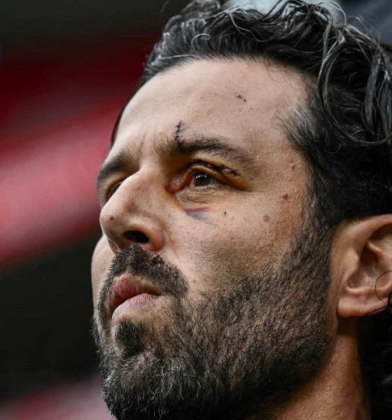 Fabio Grosso, ex allenatore del Lione